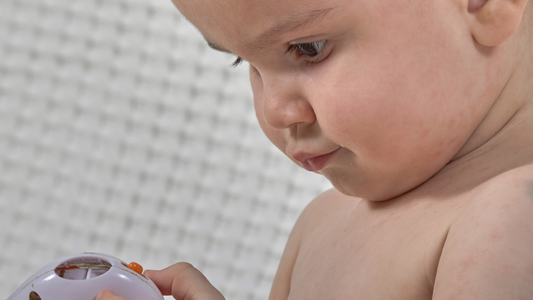 Un bébé avec de légères plaques rouges sur les joues.