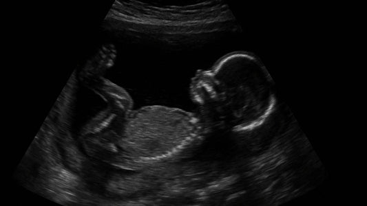 Bébé en transverse : que faire pour une naissance sereine ?