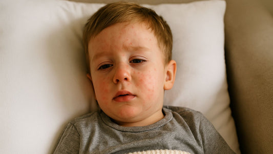 Roséole et contagion : combien de temps est-on contagieux ?